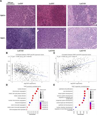 Pan-cancer experimental characteristic of human transcriptional patterns connected with telomerase reverse transcriptase (TERT) gene expression status